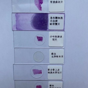 病理切片廠家**高質量生物切片基礎**專用產品顯微鏡下玻片大葉性肺炎